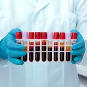 Toma de Exámenes Preventivos y Ocupacionales