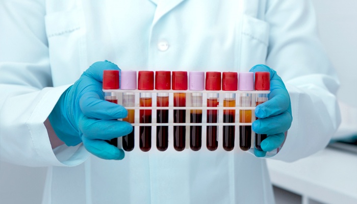 Toma de Exámenes Preventivos y Ocupacionales